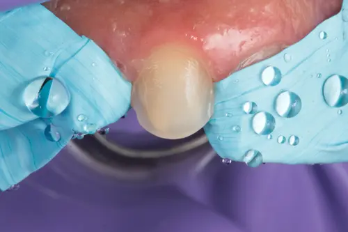 ISOTAPE - BLISTER COM 5M DE FITA DE ISOLAMENTO DEN - TDV