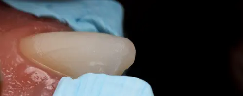ISOTAPE - BLISTER COM 5M DE FITA DE ISOLAMENTO DEN - TDV