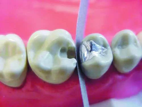 TIRAS ABRASIVAS EM ACO 6MM C/12 3052 - TDV