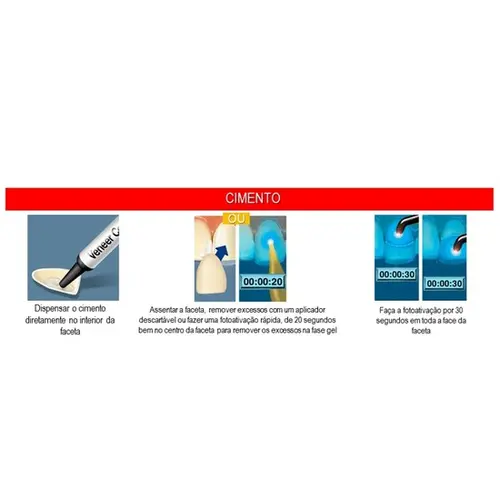 CIMENTO RESIN FOTO RELYX - VENEER B0.5 SER 3G 3M