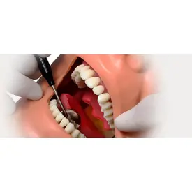 MARÇAL MDT 137 - PRONEW